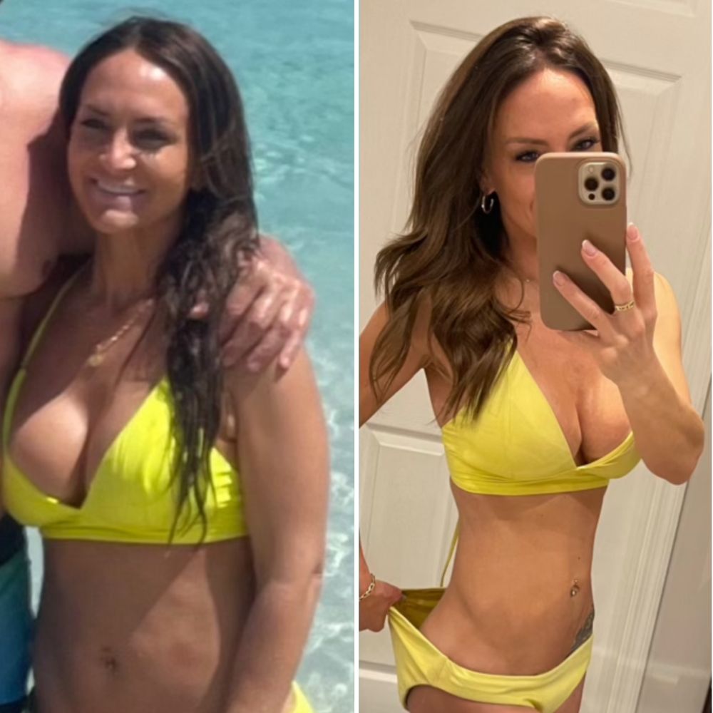 Erica R. before and after