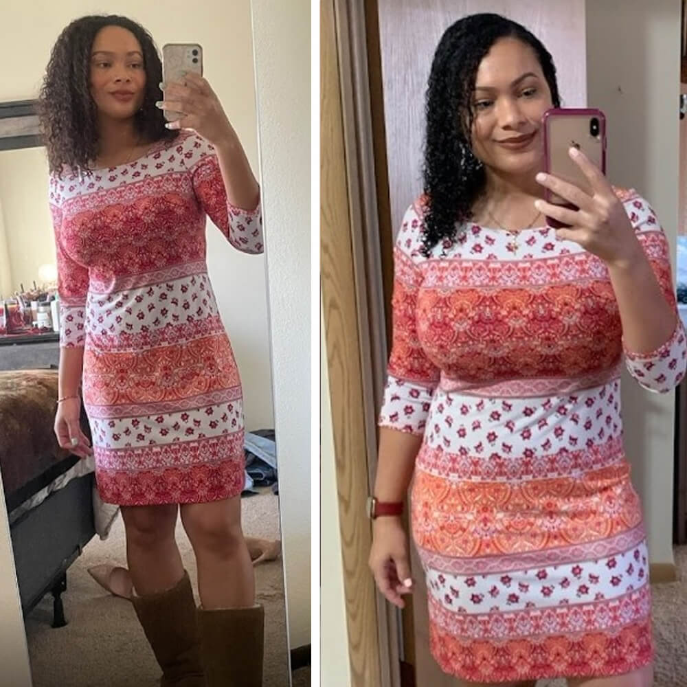 Kathie-Lee P. before and after