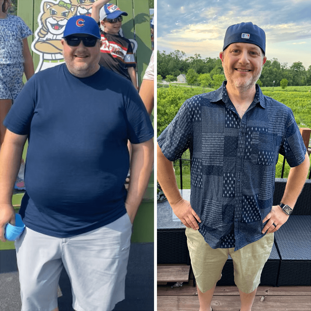 Lou L. before and after