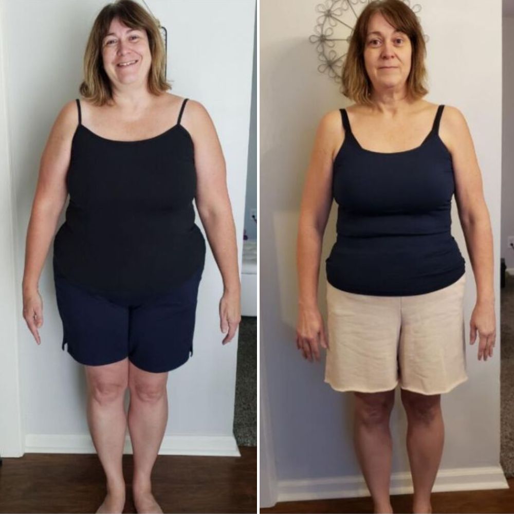 Michelle F. before and after