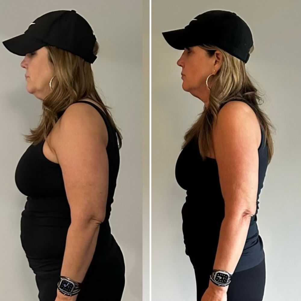 Michelle before and after