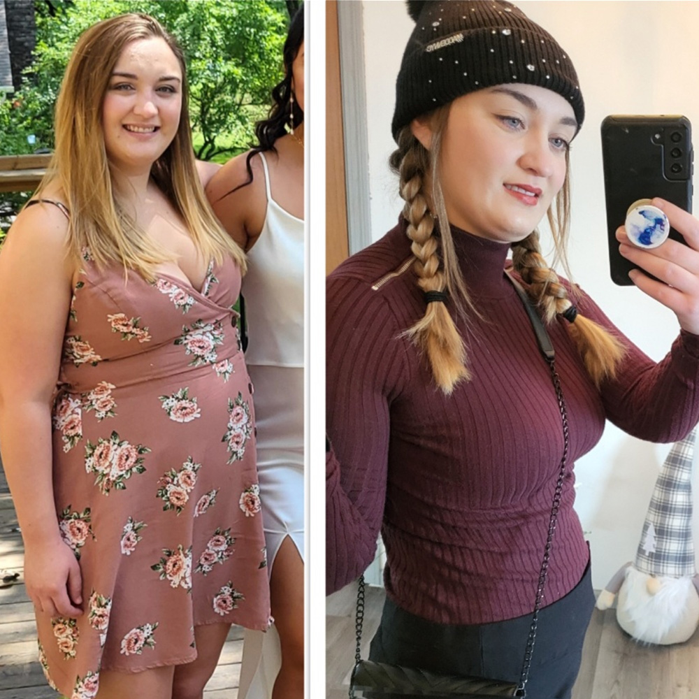 Stephanie before and after