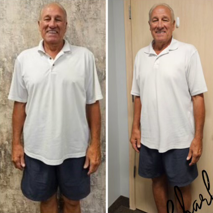 Charles J. before and after — lost 35 lbs and 20 inches in 70 days
