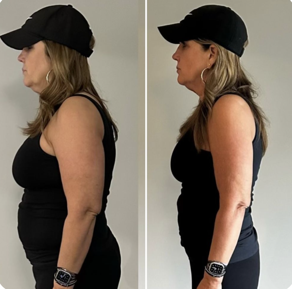 Michelle K. before and after — lost 42 lbs in 8 weeks