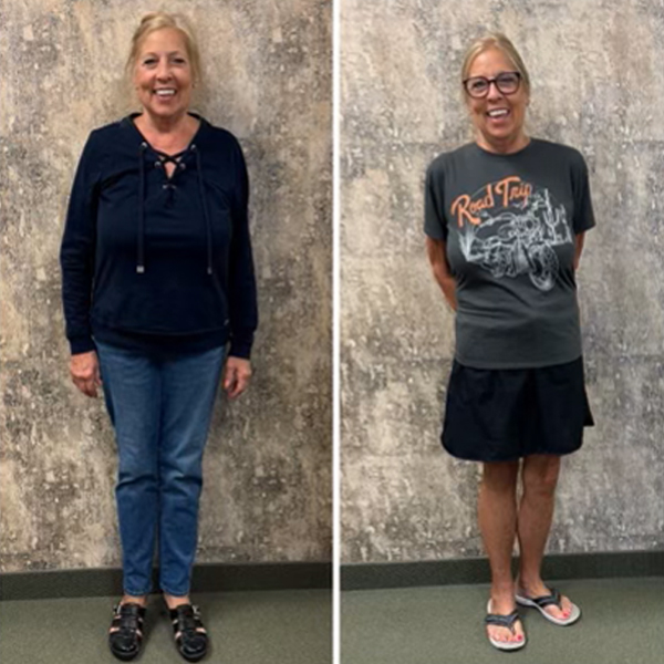 Sandy M. before and after — lost 51 lbs